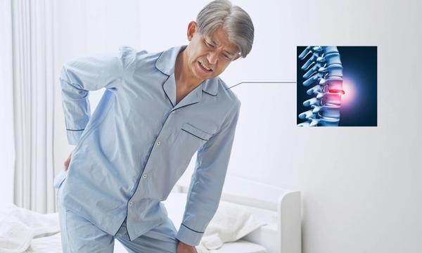 Đau lưng - bệnh lý cơ xương khớp